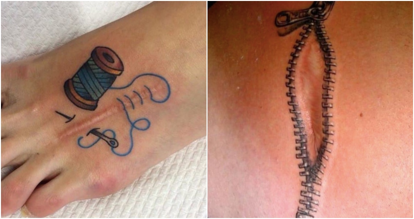10 Genius tattoos designed around body scars – Canvids